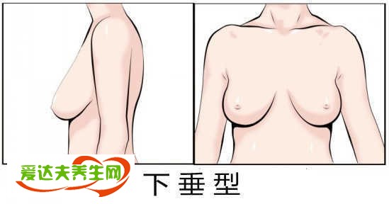 胸型有哪几种图解，对应内衣怎么选择