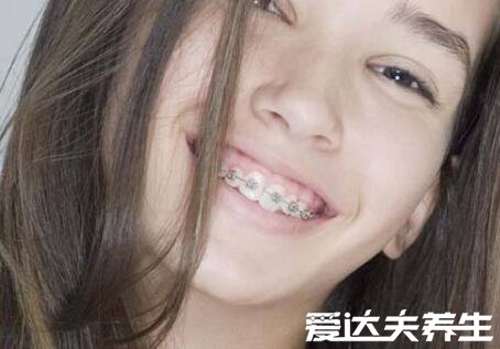 带牙套的年龄，12到18岁最适合带牙套(三大注意事项)