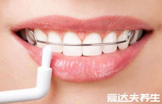 5类人不能做牙齿整形，有这五种状况的人注意了