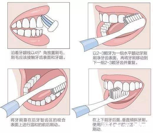 巴氏刷牙法的精髓是倾斜45°刷，教你快速掌握科学刷牙(附视频)