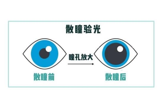正常瞳孔和瞳孔放大图，非正常对光反应可能是青光眼