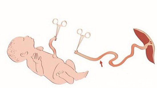 宝宝脐带血有必要保存吗，性价比不高但有家族血液病的需保存