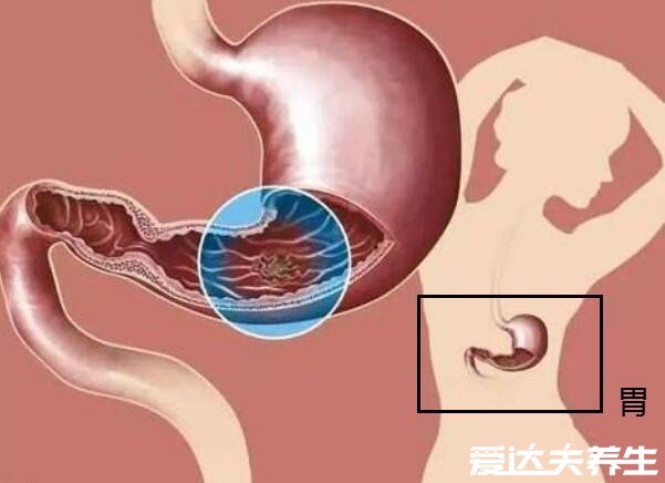 胃在哪个位置图，胃的位置图片