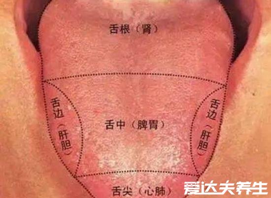 超详细胃癌早期舌头图片，舌苔发黑无知觉一定要引起重视