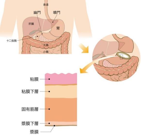 胃在什么位置图片，胃在左肋骨下及腹部中上区域