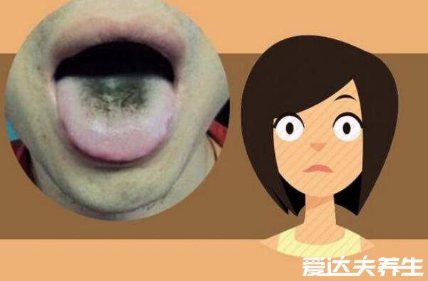 胃癌早期舌头图片，舌苔发黑舌边有红刺一定要注意