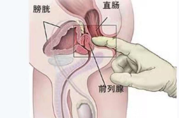 自己按摩前列腺十种手法图解，按摩这几处穴位很重要