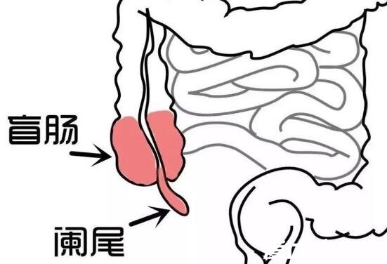 阑尾炎的疼痛位置图片，位于盲肠与回肠之间人体的右下腹处