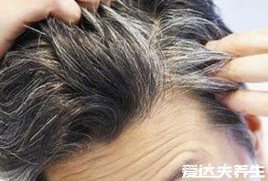 三个部位长白发最危险，两鬓/后脑勺/前额头有可能影响性生活