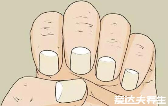 指甲上的月牙代表什么，代表身体健康情况又名健康圈