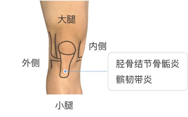 膝盖各个部位疼痛图解，不同位置疼痛代表不同疾病(两侧疼最严重)
