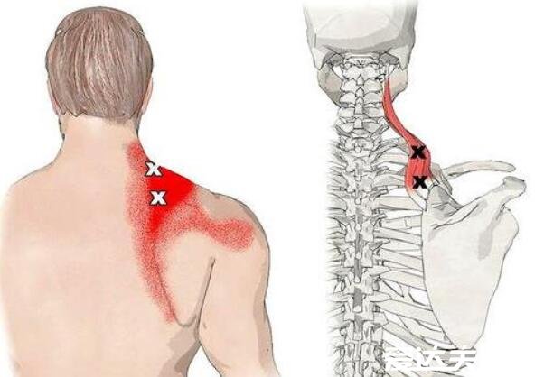 后背疼痛位置图详解，后背偏下疼可能是消化系统疾病
