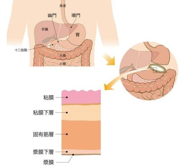胃在什么位置图片，左上腹靠近心窝的凹陷处