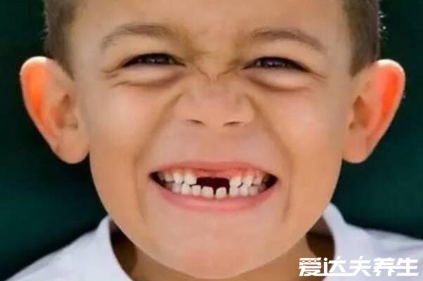 详细儿童换牙顺序图，6岁左右换乳牙长恒牙(5大注意事项)