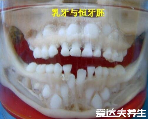 小孩换牙前的颅骨图，虽然吓人但确实是真实的(有图慎点)