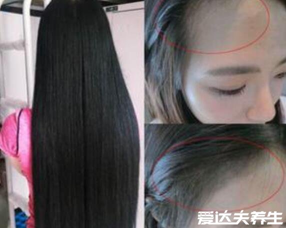 八个方法让头发变浓密，使用气垫按摩梳生发(亲测有效)
