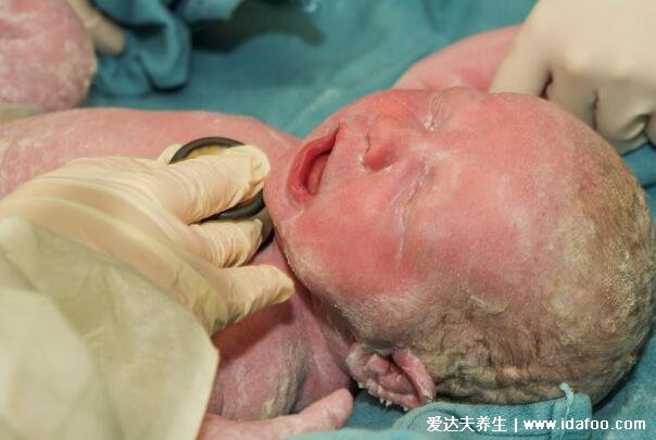 刚出生的宝宝图片，有点丑和粉嫩两个字完全不沾边