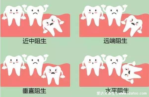 如何判断自己长智齿了，上下各14颗牙多出来的就是智齿