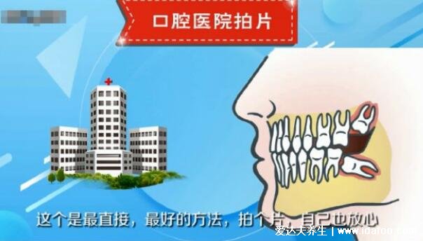 如何判断自己长智齿了，上下各14颗牙多出来的就是智齿