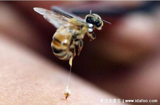 蜜蜂蛰了怎么消肿止痒的最快方法，处理红肿肥皂清洗最佳