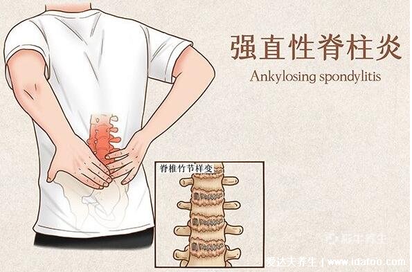 重视后背疼的原因，5个疾病会引起后背疼(最严重的是肝胆疾病)