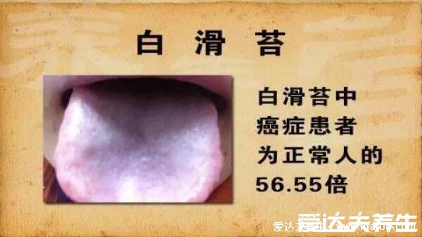 胃癌的五大早期症状，和胃炎相似/吐血黑便(胃癌早期舌头图片)