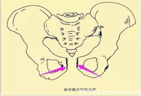 耻骨是哪个部位图片，孕期中晚期女性容易耻骨疼