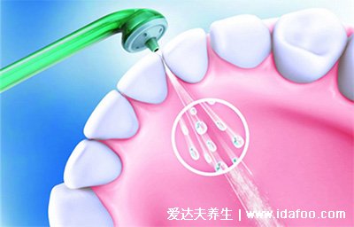 洗牙的好处和坏处，可以预防牙龈疾病但是容易损坏牙龈