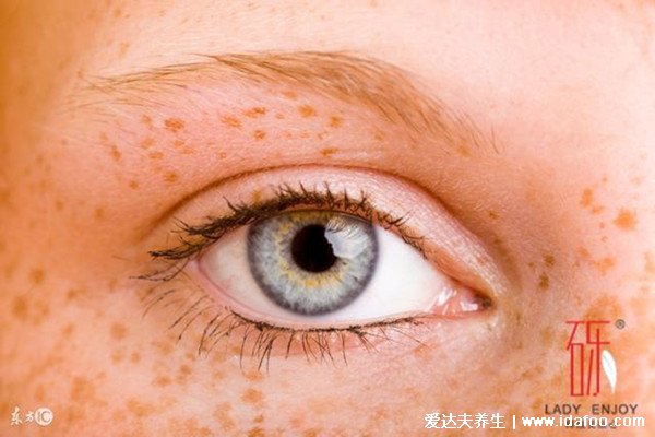 女人长斑的位置图解，化妆残留可致眼尾长斑