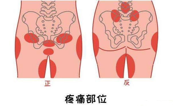 耻骨是哪个部位图片，大腿根部和小腹交界的位置(孕妇必看)
