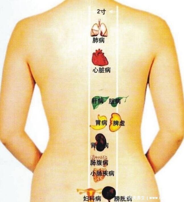 人体器官后背疼痛对应器官图，各个位置疼痛病灶解析(在家自诊)