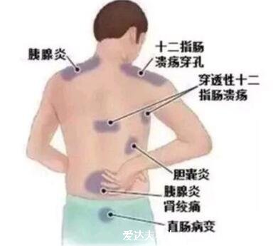 慢性胆囊炎后背疼的位置图片，发作时右背部或右肩部疼