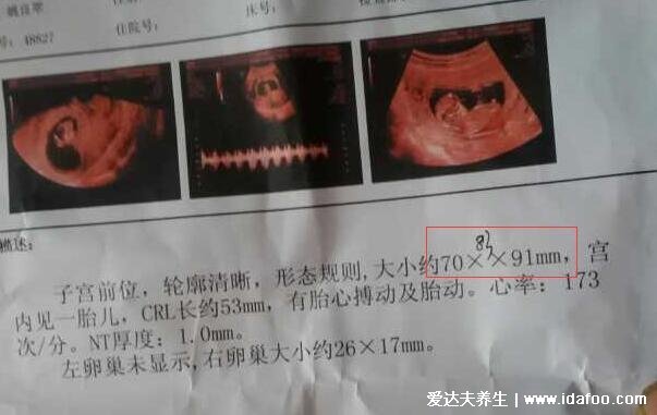 生男生女其实看孕囊很准，看6-7周孕囊大小的两个数据准爆了