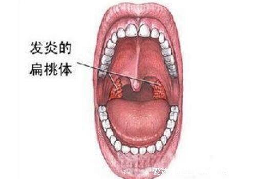 舌头根部有疙瘩图片，每个人都有的轮廓乳头也就是味蕾(3大原因)