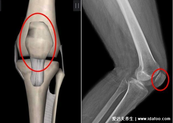 髌骨是哪个部位图片，人膝盖各个部位疼痛图解(膝盖正中心)