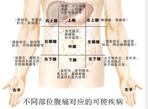 胰腺炎是哪个部位疼图解图片，在左上腹位置（也可放射到肩部）