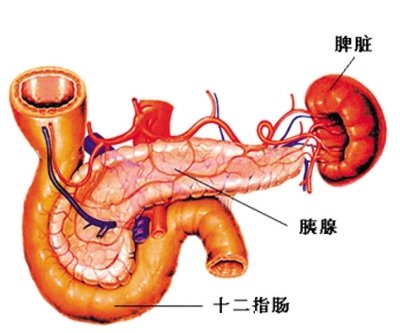 胰腺炎是哪个部位疼图解图片，在左上腹位置（也可放射到肩部）