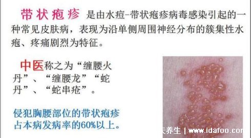 各种皮疹图片和症状图片介绍，包括风疹/手足口病/荨麻疹
