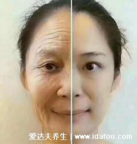 脸部保养和不保养经典图片，刘德华和范伟的区别就是典型例子
