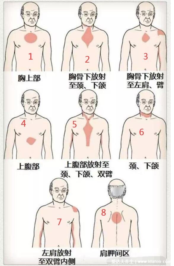 人体器官后背疼痛对应器官图，9处致命的心脏疼痛位置图