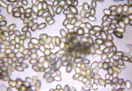 如何判断老公感染霉菌，霉菌感染初期症状图片(红斑和白色分泌)