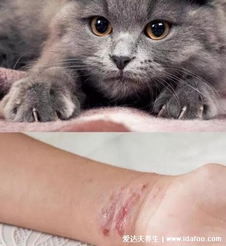 为什么好多人被猫抓不打疫苗，可能是给猫打针了