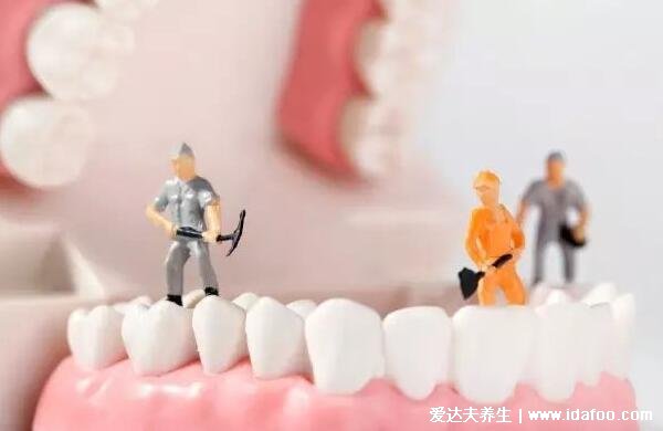 洗牙能让牙齿变白吗?只能还原牙齿本色清洁掉污渍