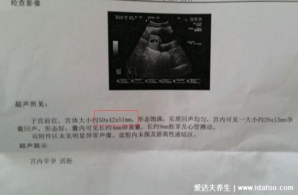 清宫图2021年生男生女表(正版），看年龄怀孕月份(附生男女公式)