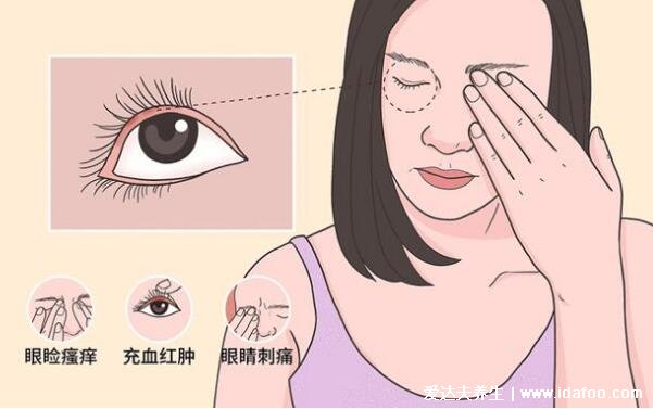 麦粒肿快速消除的方法，涂红霉素眼膏亲测有效(附图片症状)