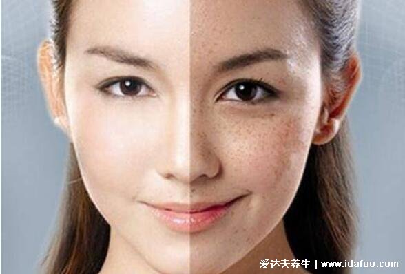 维生素e直接涂在脸上可以祛斑吗，教你涂脸正确用法能淡斑