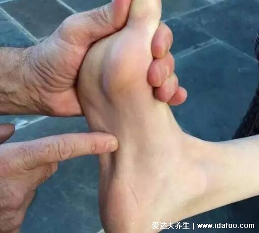 3个足底筋膜炎痛点图片，经常脚后跟疼的注意了(附治疗法)