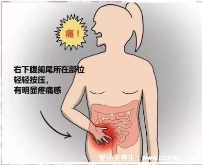 阑尾炎是哪个部位疼位置示意图片，右下腹按压痛(早期上腹肚脐疼)