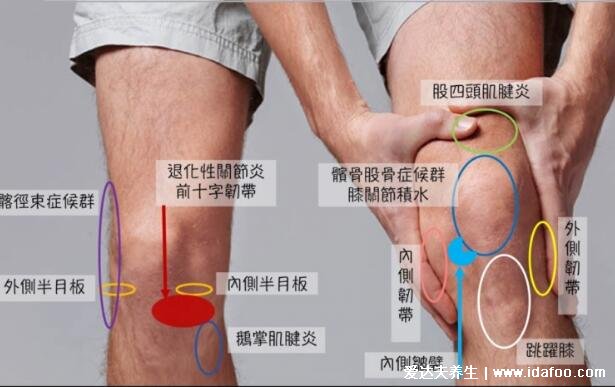 膝盖疼痛是怎么回事?膝盖各个部位疼痛图解(两侧疼最严重)