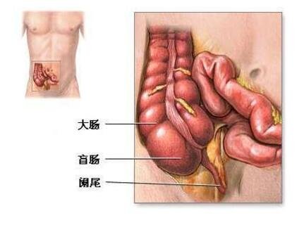女性阑尾炎的疼痛位置图片，会转移性右下腹按压痛(刚开始上腹肚脐疼)